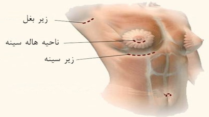 انواع برش‌ها
