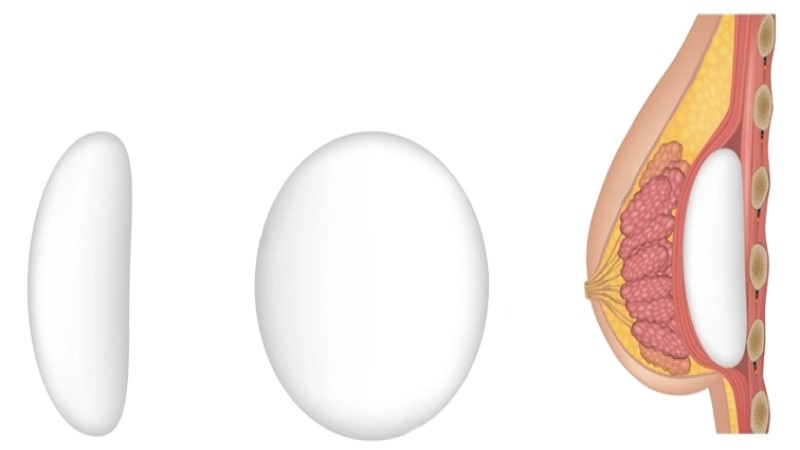 پروتز گرد