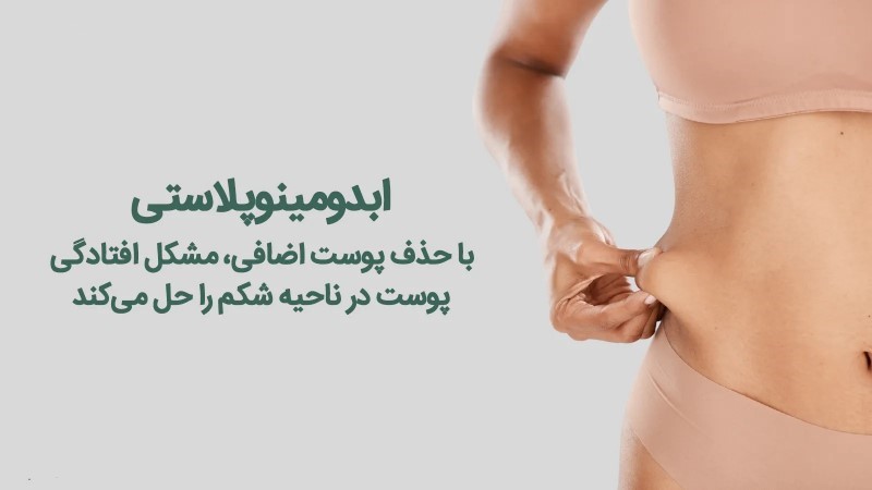 اقدامات قبل از ابدومینوپلاستی چرا مهم است؟