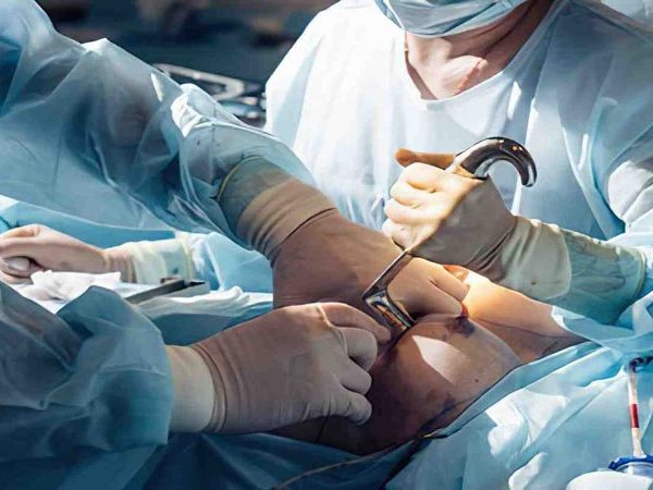 عوارض عمل ماموپلاستی