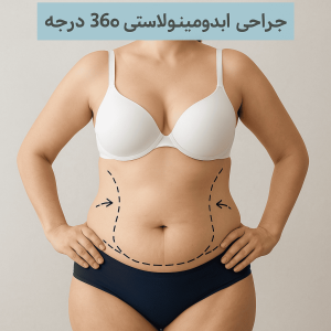 ابدومینوپلاستی 360 درجه ابدومینوپلاستی 360 درجه